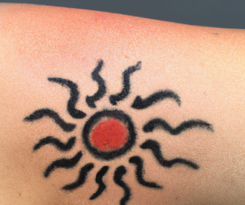 Sun .. sun .. sunburned!!